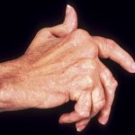 hand