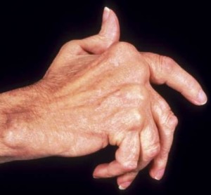 hand